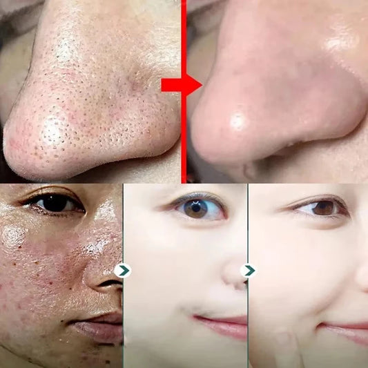 Masque Facial Original pour éliminer les points noirs, thé vert, solide, traitement des imperfections d'acné, points noirs, bâton propre, crème rétrécit les Pores, soins de la peau