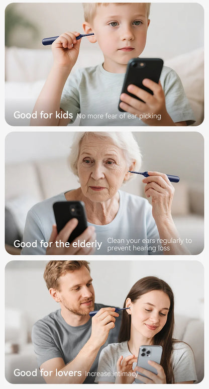 Nettoyeur de cire d'oreille visuel intelligent amélioré avec caméra, Endoscope HD 800W, outil de nettoyage visuel multifonctionnel d'oreille, comprend un stockage