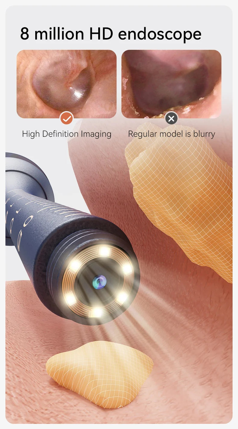 Nettoyeur de cire d'oreille visuel intelligent amélioré avec caméra, Endoscope HD 800W, outil de nettoyage visuel multifonctionnel d'oreille, comprend un stockage
