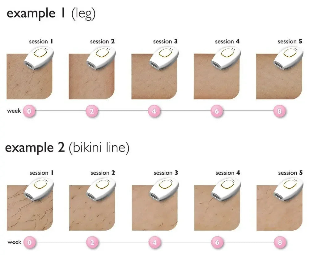500000   Flash indolore Laser IPL épilateur femmes rasoir épilation permanente pour corps visage Bikini aisselles Machine d'épilation