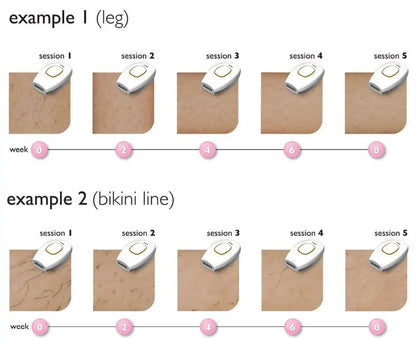 500000   Flash indolore Laser IPL épilateur femmes rasoir épilation permanente pour corps visage Bikini aisselles Machine d'épilation