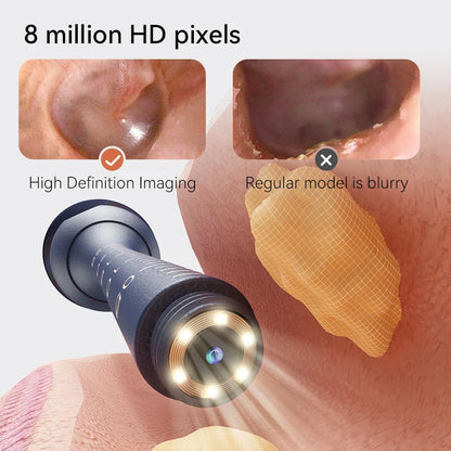 Nettoyeur de cire d'oreille visuel intelligent amélioré avec caméra, Endoscope HD 800W, outil de nettoyage visuel multifonctionnel d'oreille, comprend un stockage