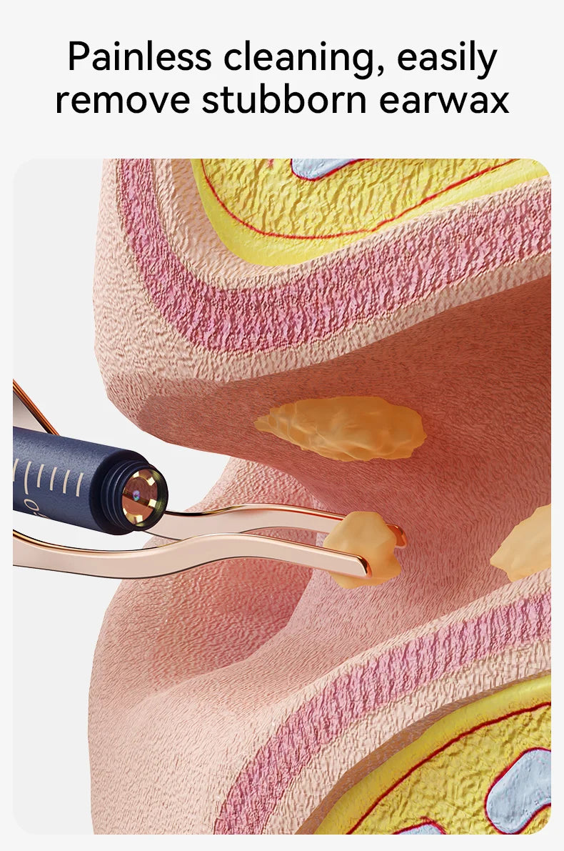Nettoyeur de cire d'oreille visuel intelligent amélioré avec caméra, Endoscope HD 800W, outil de nettoyage visuel multifonctionnel d'oreille, comprend un stockage